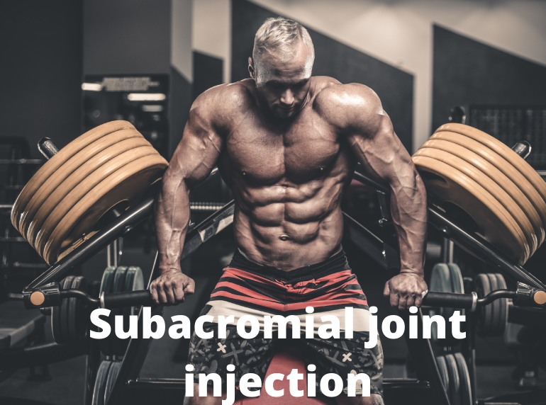 Subacromial joint injection